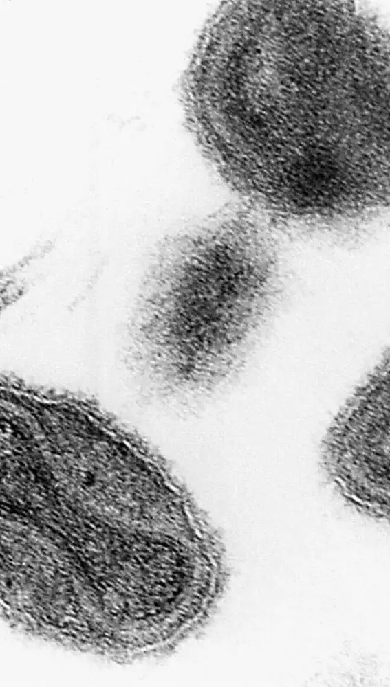 Muestras del virus de la viruela tomadas en 1975