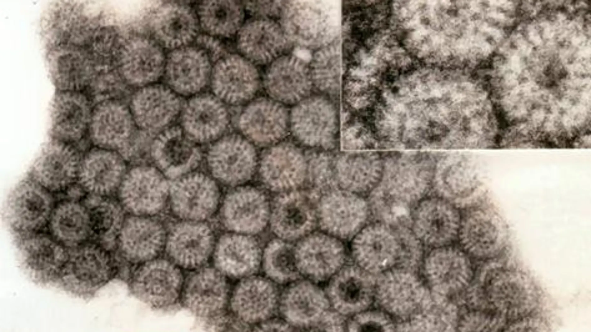 El rotavirus es un virus esférico de unos 75 nanómetros de diámetro con aspecto de rueda