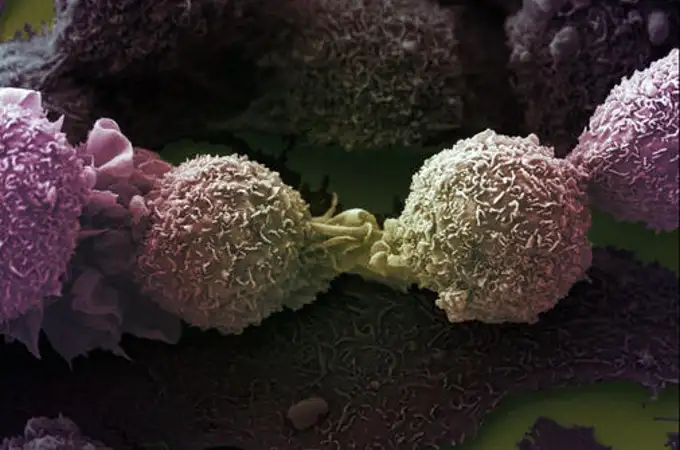 Diseñan una molécula capaz de entrenar al sistema inmune para prevenir algunos tipos de tumores