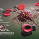 Antioxidantes, ¿un enemigo de la lucha contra el cáncer?