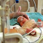Imagen de archivo de un bebé prematuro en una incubadora