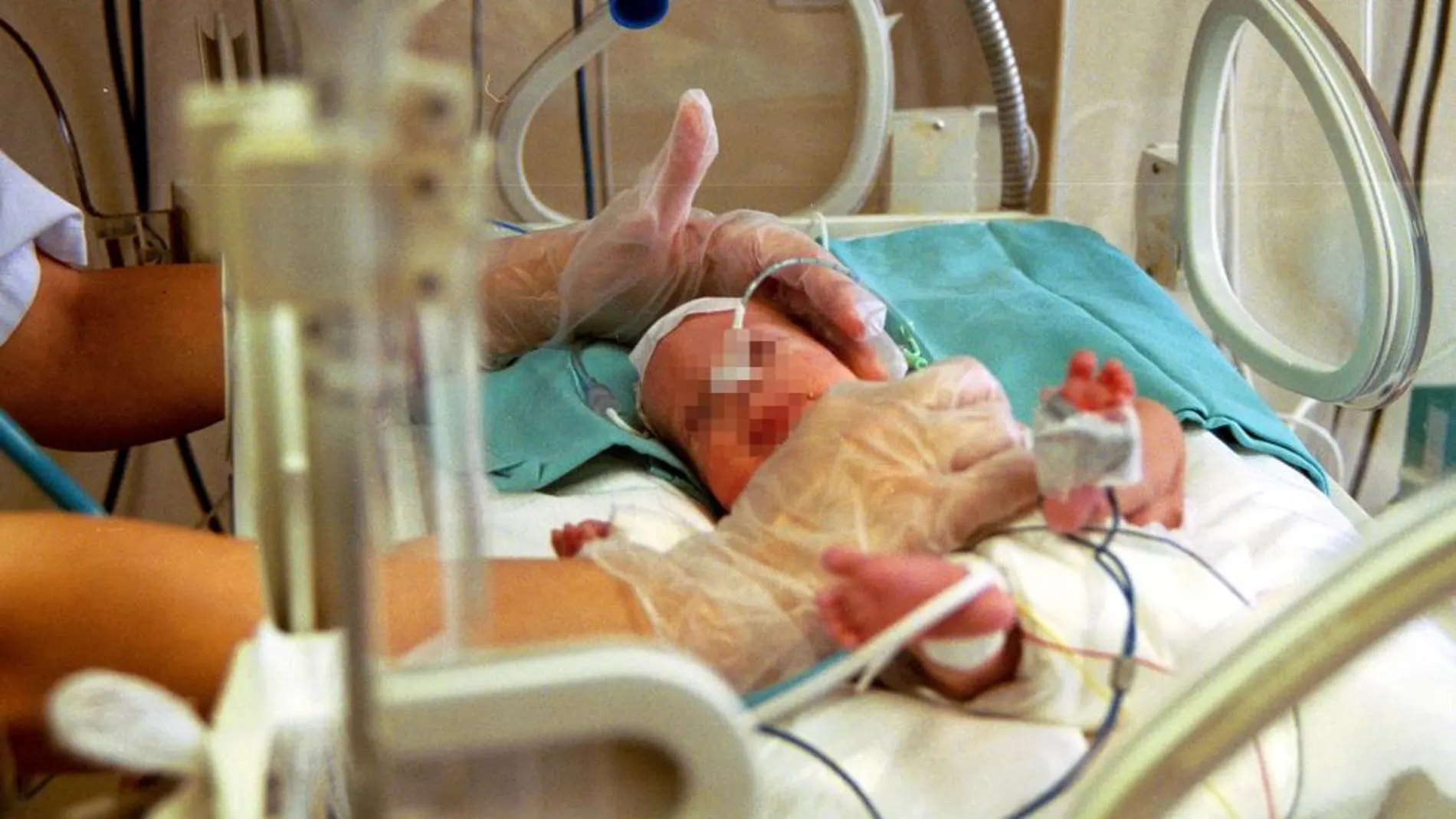 Imagen de archivo de un bebé prematuro en una incubadora