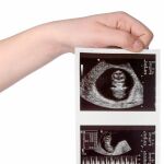 Uno de cada cinco embarazos acaba en aborto