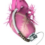 Corazón Mecánico