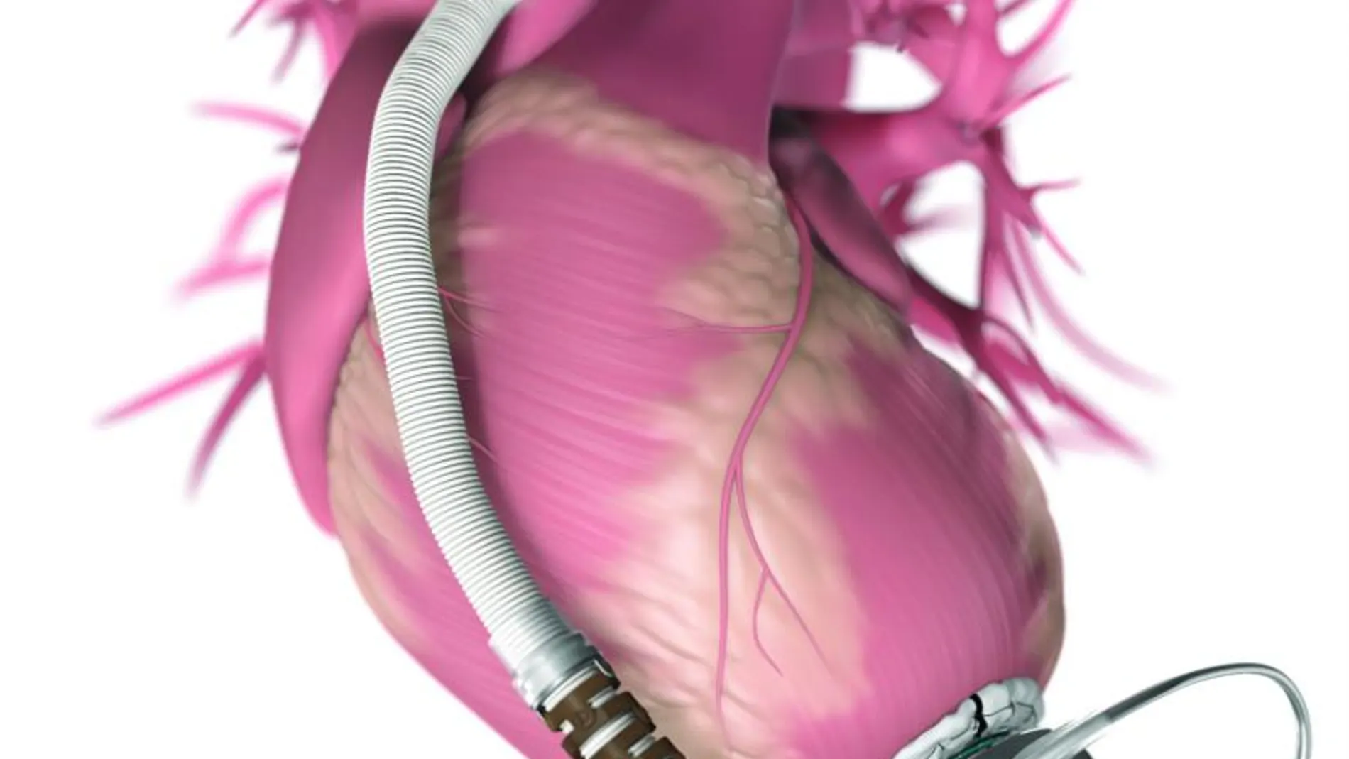 Corazón Mecánico