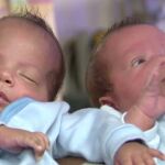 Dos hermanos gemelos nacen con 24 días de diferencia