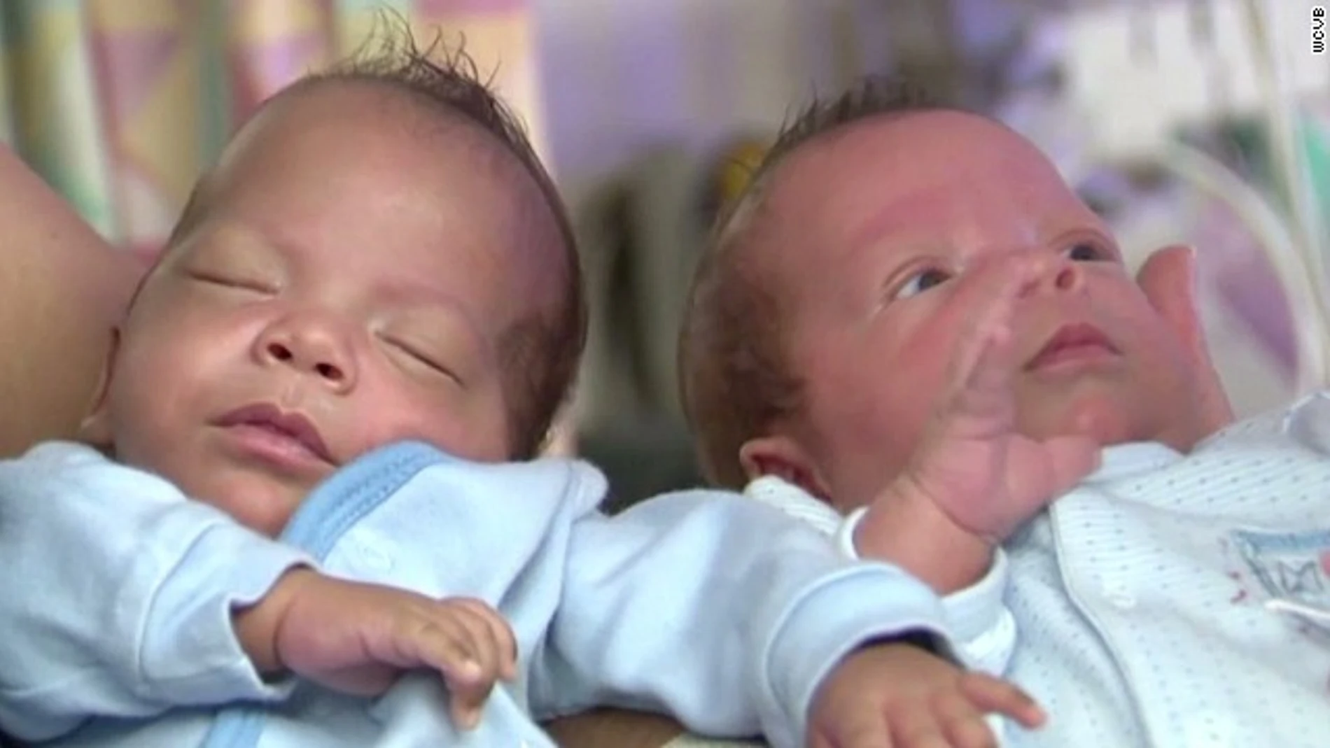 Dos hermanos gemelos nacen con 24 días de diferencia
