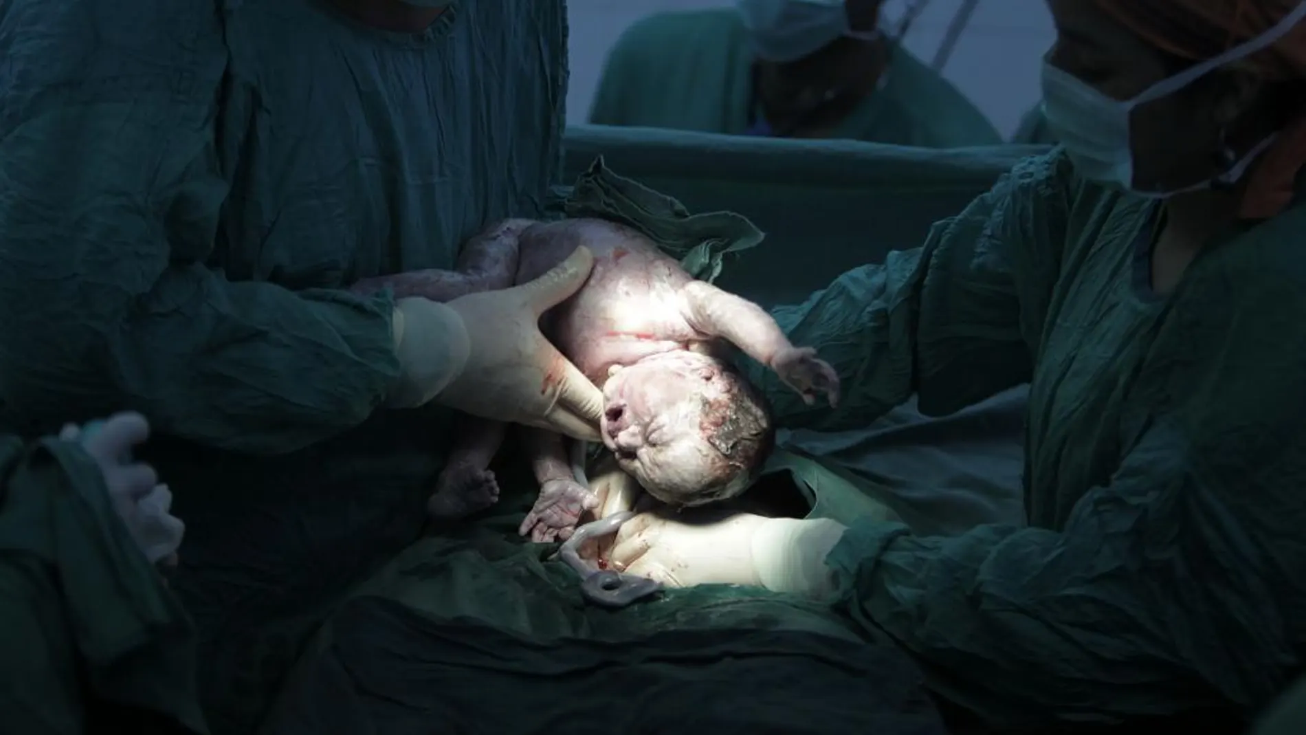 Un bebé en el momento de su nacimiento
