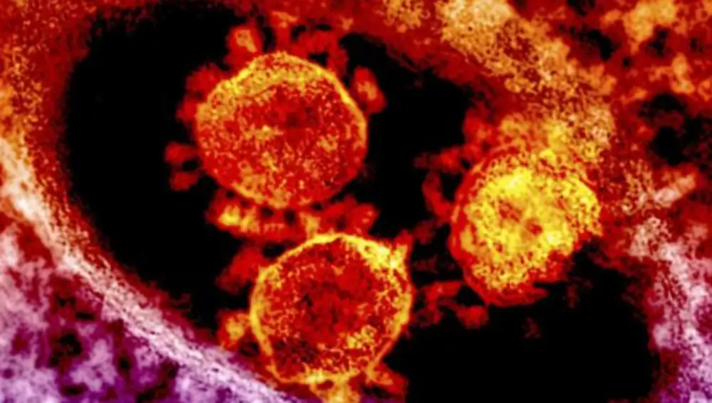Partículas del coronavirus a la vista de microscópico