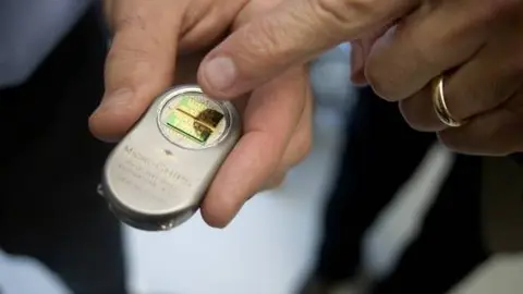 Inventan un anticonceptivo que dura 16 años y puede desactivarse por control remoto