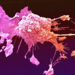El virus que ataca al cáncer sin dañar las células sanas