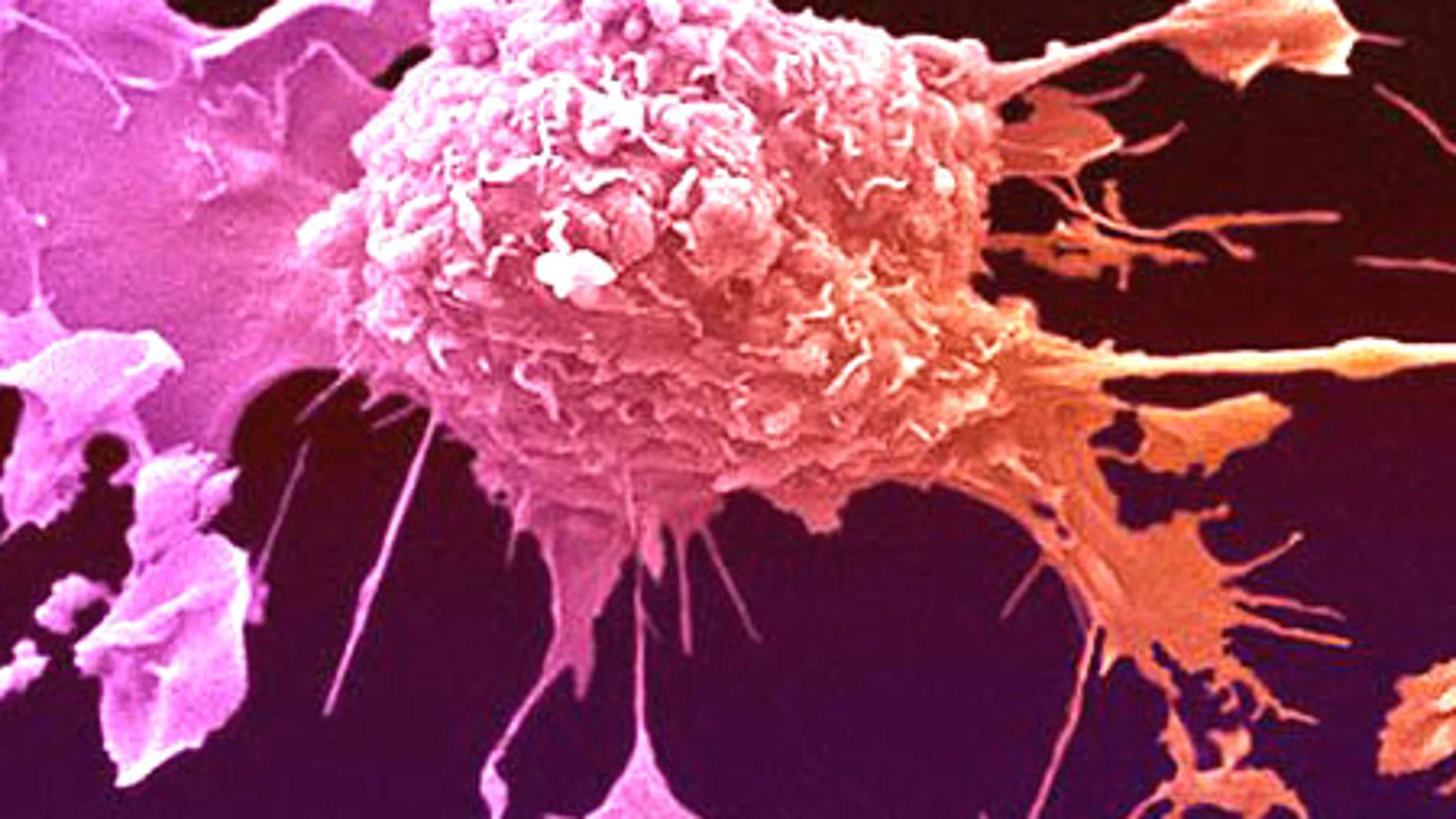 El virus que ataca al cáncer sin dañar las células sanas