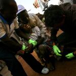 Trabajadores sanitarios extraen un gusano de la pierna de una niña en Ghana