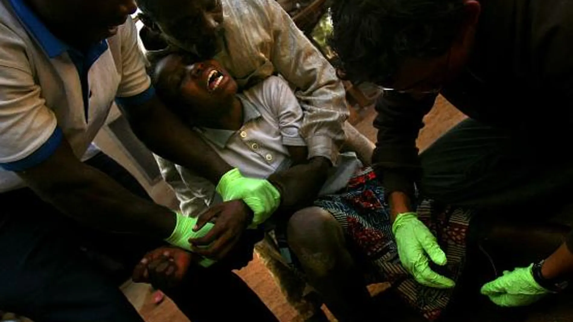 Trabajadores sanitarios extraen un gusano de la pierna de una niña en Ghana