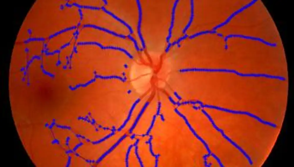 Análisis de la ramificación de venas y arterias en la retina