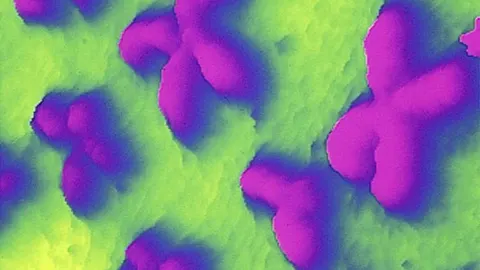 Cromosomas humanos, vistos al microscopio