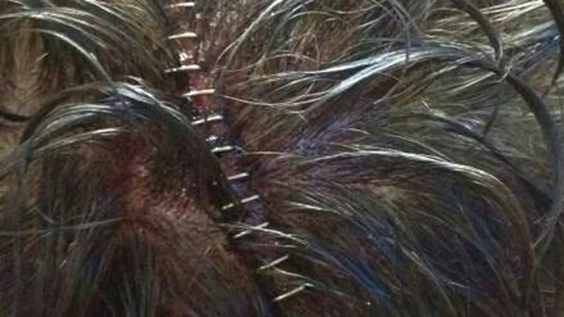 Imagen de la cicatriz de uno de los policías agredidos en Madrid