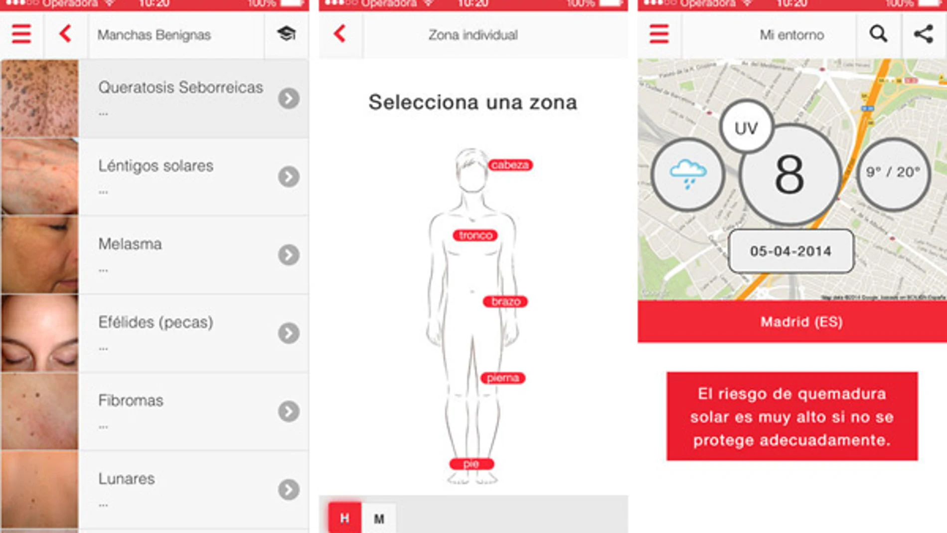 Prevenir el cáncer de piel es ahora más sencillo con la app Fotoskin