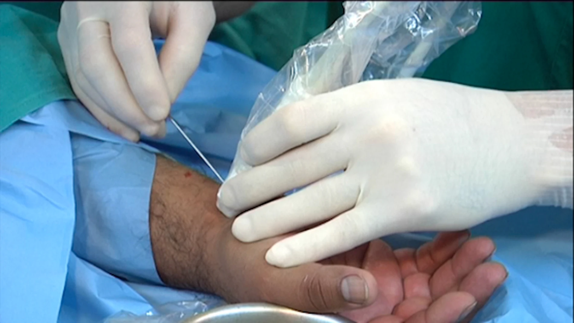 España está al «primer nivel» mundial en cirugía de mano