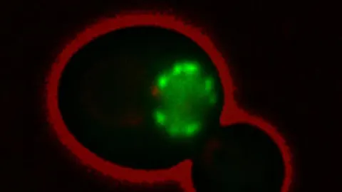 Fotografía de microscopio de fluorescencia de una célula de 'Saccharomyces cerevisiae', en rojo, en crecimiento mitótico expresando una proteína en verde