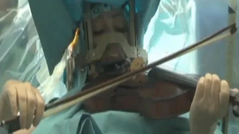 Una mujer toca el violín mientras la operan del cerebro