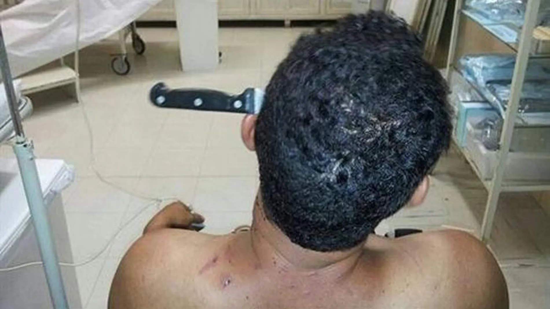 Un hombre camina por la calle con un cuchillo clavado en la cabeza