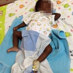 Nace un niño con ocho extremidades en Uganda