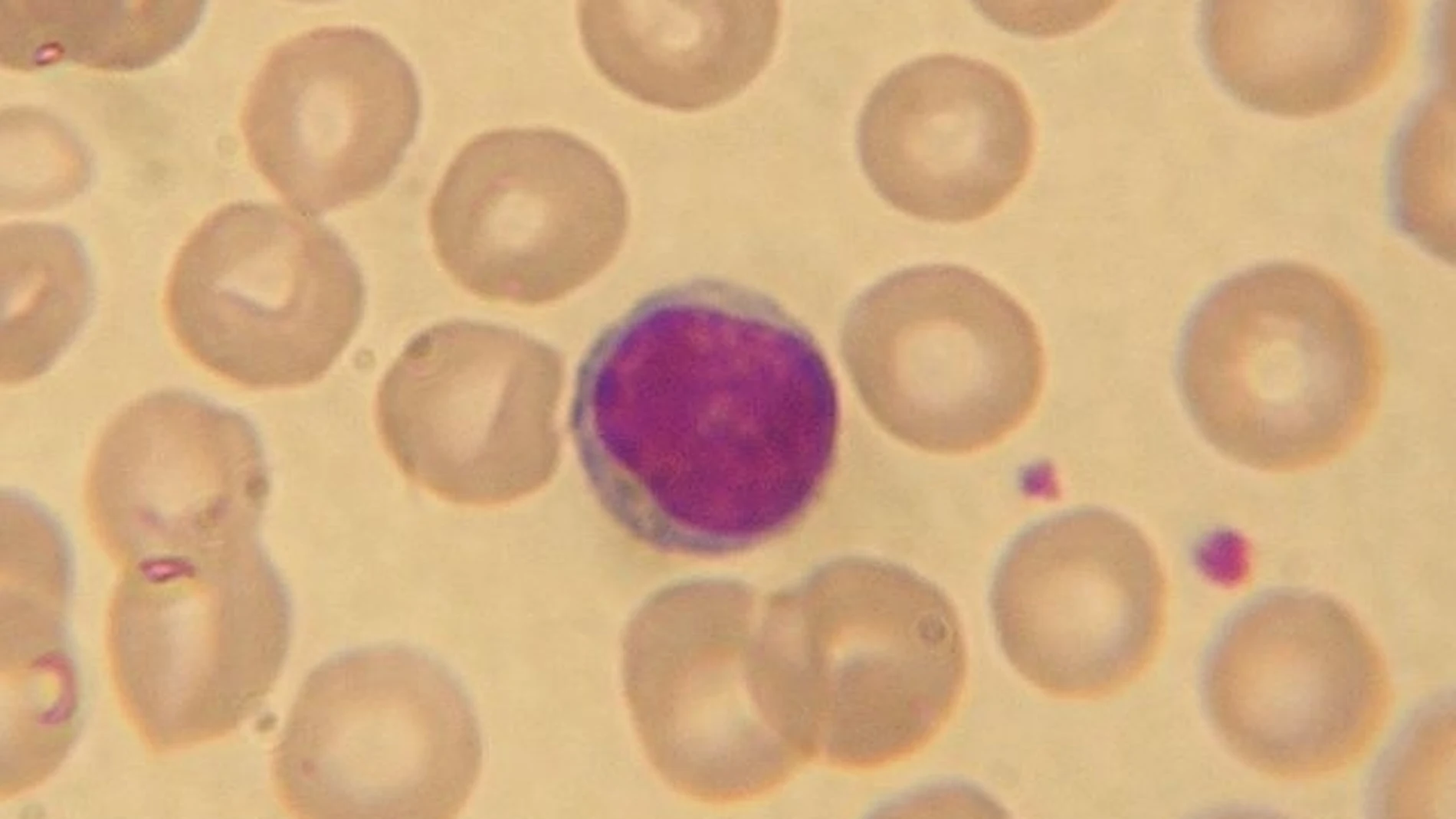 Imagen de un linfocito rodeado de glóbulos rojos