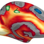 El rojo y el amarillo indican las áreas del cerebro más activas cuando las imágenes fueron valoradas como altamente estimulantes. El color verde indica las áreas que, específicamente, se volvieron más activas en las mujeres