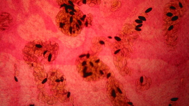 Vista microscópica de Fasciola hepatica