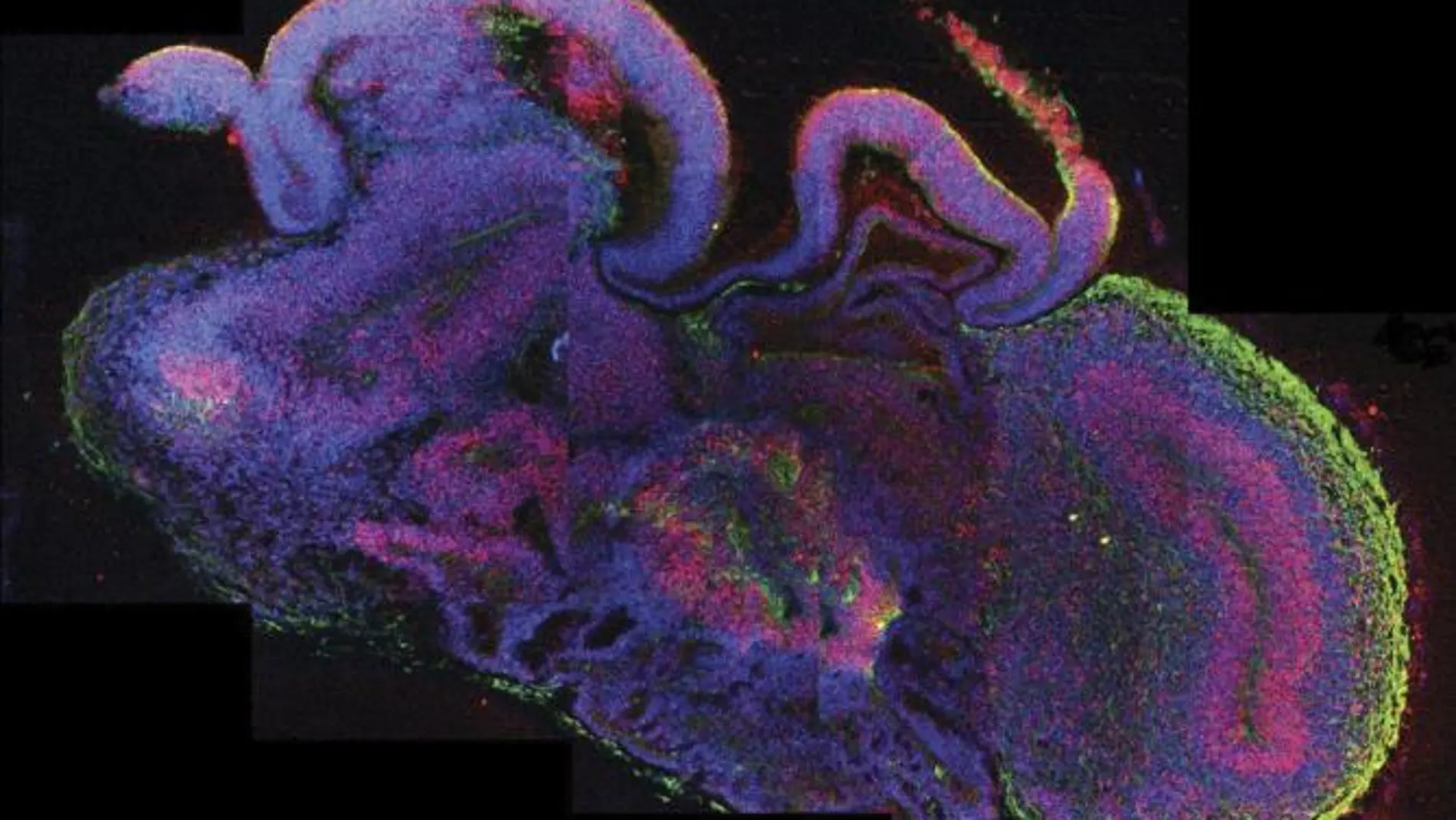 Sección de un órgano cerebral con diferentes regiones cerebrales.