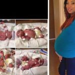 Una mujer muere después de dar a luz a cuatrillizos
