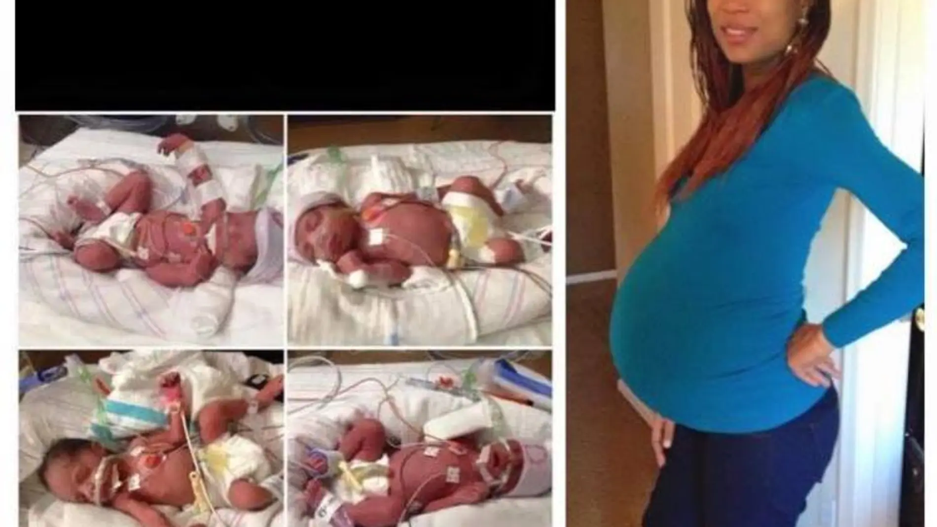 Una mujer muere después de dar a luz a cuatrillizos