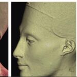 El lifting de Nefertiti