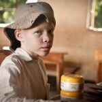 Un niño con albinismo con la crema Kilimanjaro Suncare