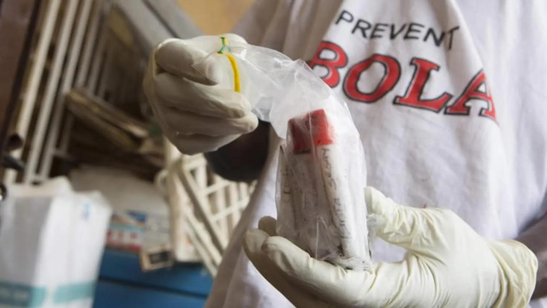 Muestras de sangre de sospechosos de tener el virus