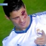 Ha sido David Navarro quien más daño ha hecho al portugués. Un codazo le rompió la ceja. Ronaldo siguió jugando