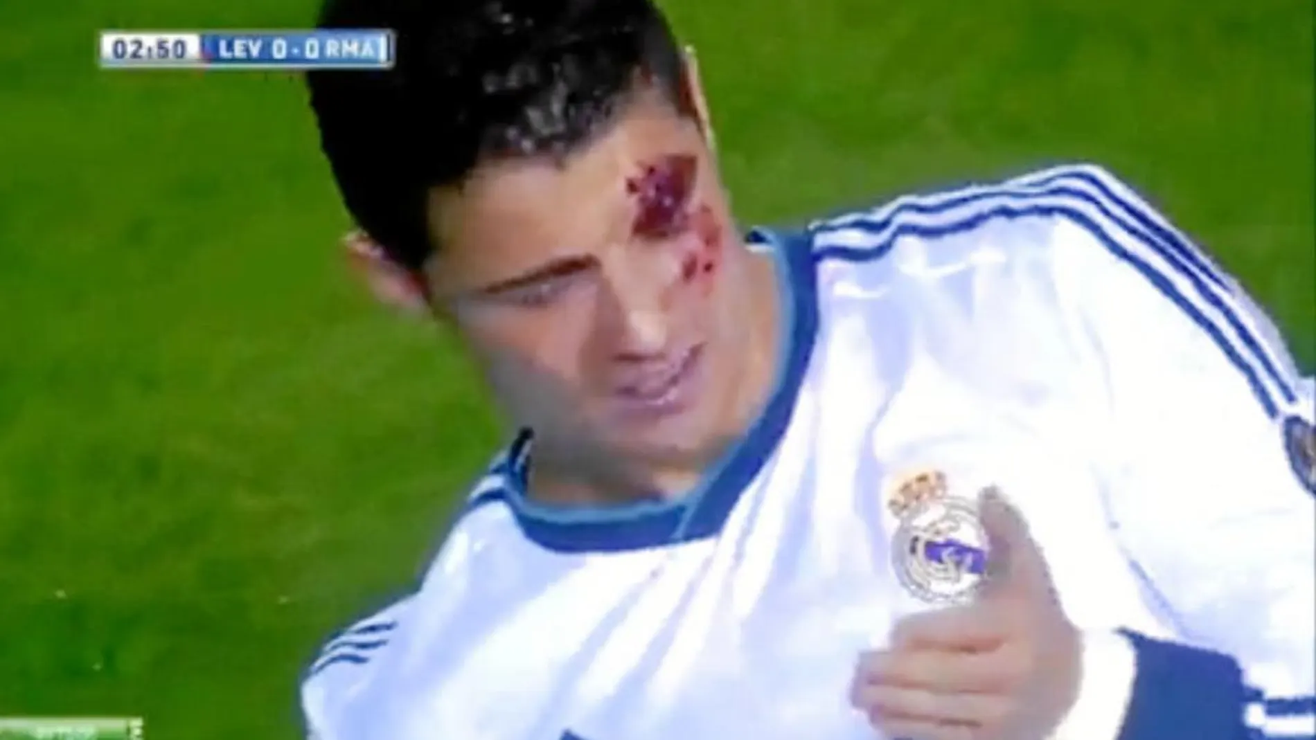 Ha sido David Navarro quien más daño ha hecho al portugués. Un codazo le rompió la ceja. Ronaldo siguió jugando