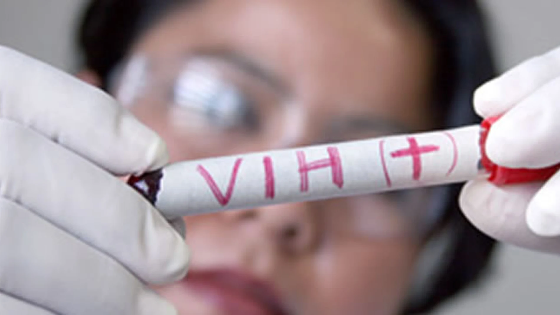 Jóvenes «sin miedo» al VIH, perfil de los nuevos infectados