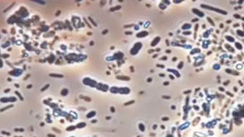 El CSIC lidera un estudio que abre nuevas vías para tratar el lupus