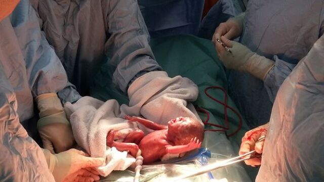 La imagen que vuelve a abrir el debate de la ley del aborto en Reino Unido