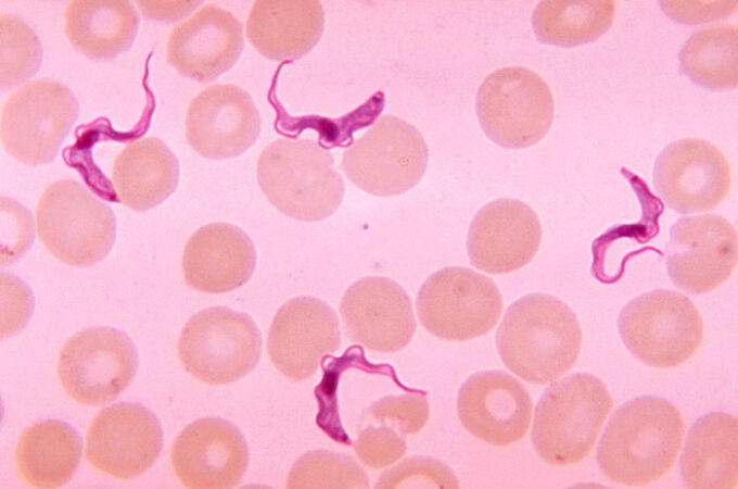 Tripanosomiasis o enfermedad del sueño en sangre