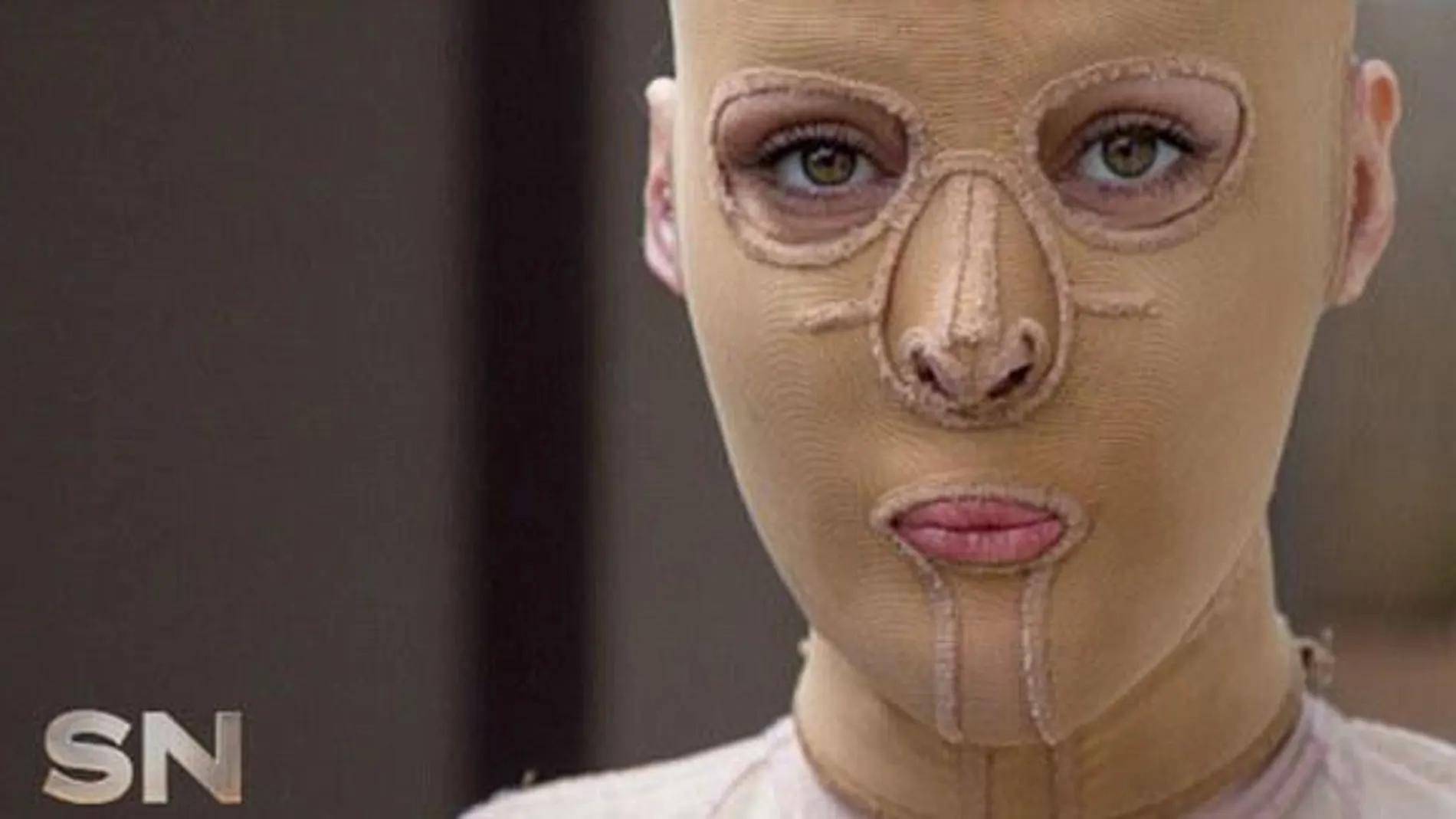 La mujer sin rostro hace pública su nueva imagen