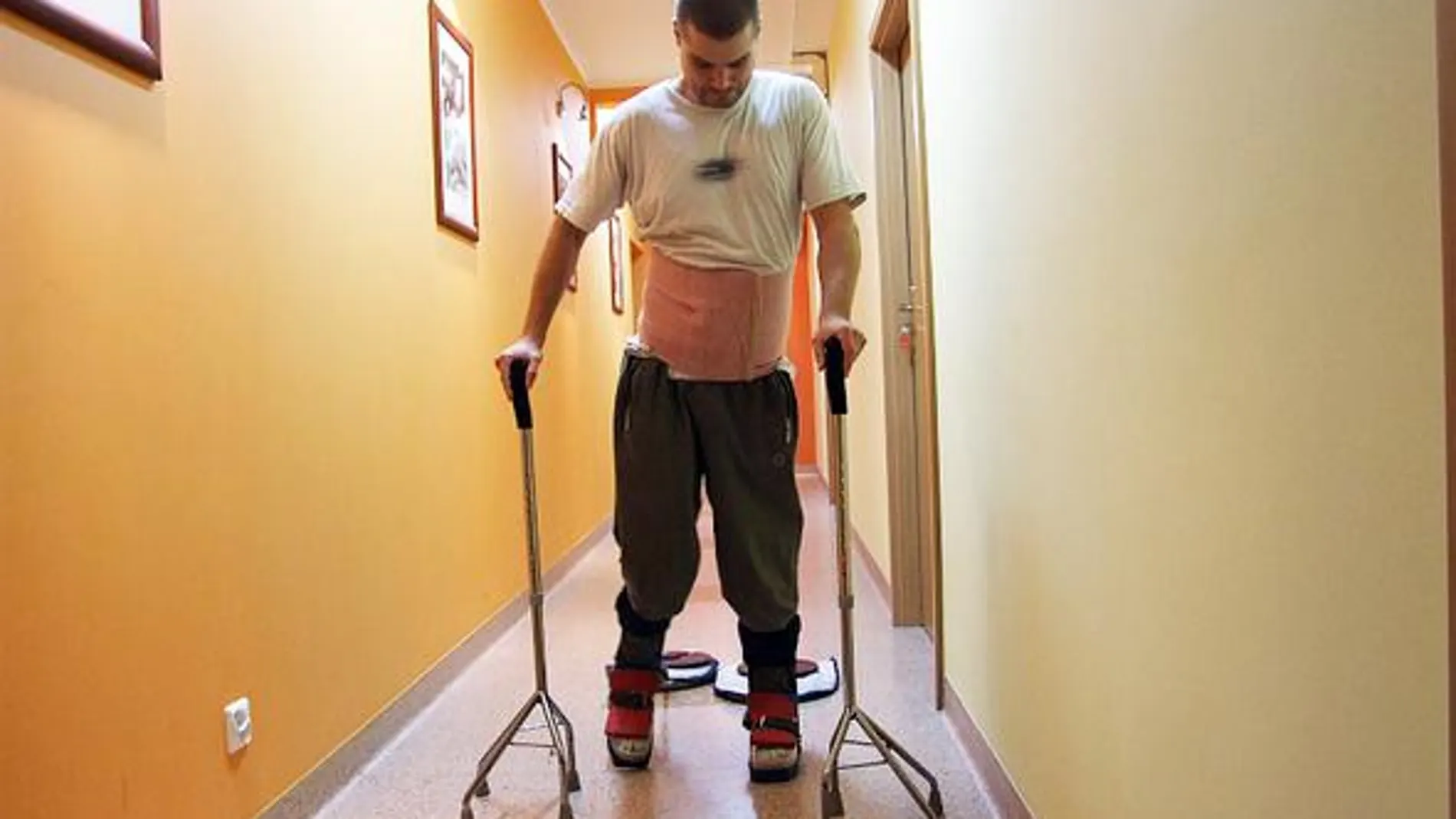 Un paciente realiza ejercicios de rehabilitación en el mismo centro polaco que trata a Darek Fidyka