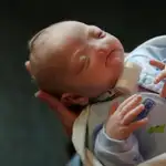  Eli, el bebé que nació sin nariz