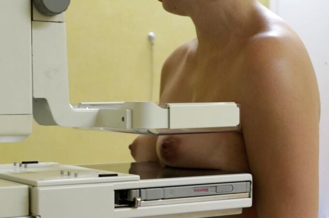 Dos tercios de los ensayos contra el cáncer de mama inflaron sus resultados