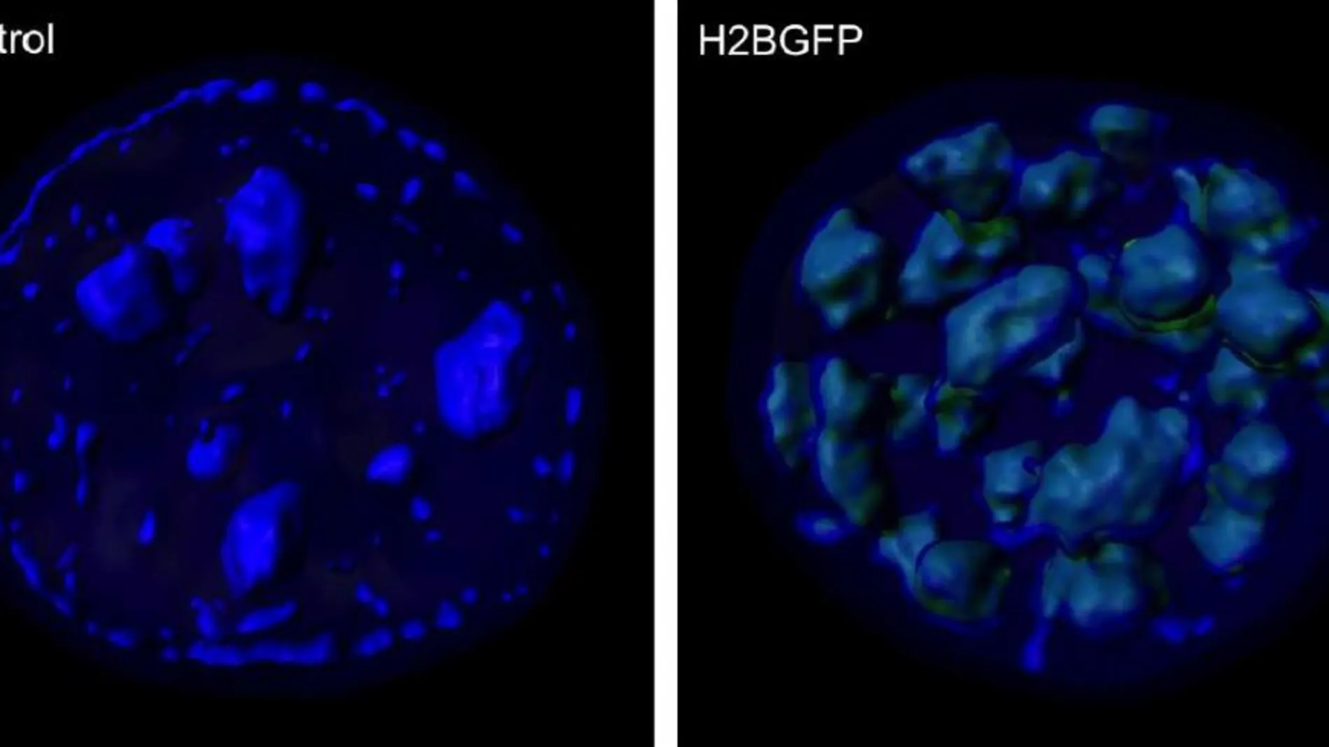 Determinan el impacto que tienen en la función neuronal las alteraciones en la estructura tridimensional de la cromatina