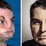Dos imágenes que reflejan la incrleíble transformación de Norris