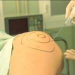Diez cosas que has de saber antes de hacerte una liposución