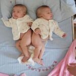 Imagen de las dos hermanas antes de la operación